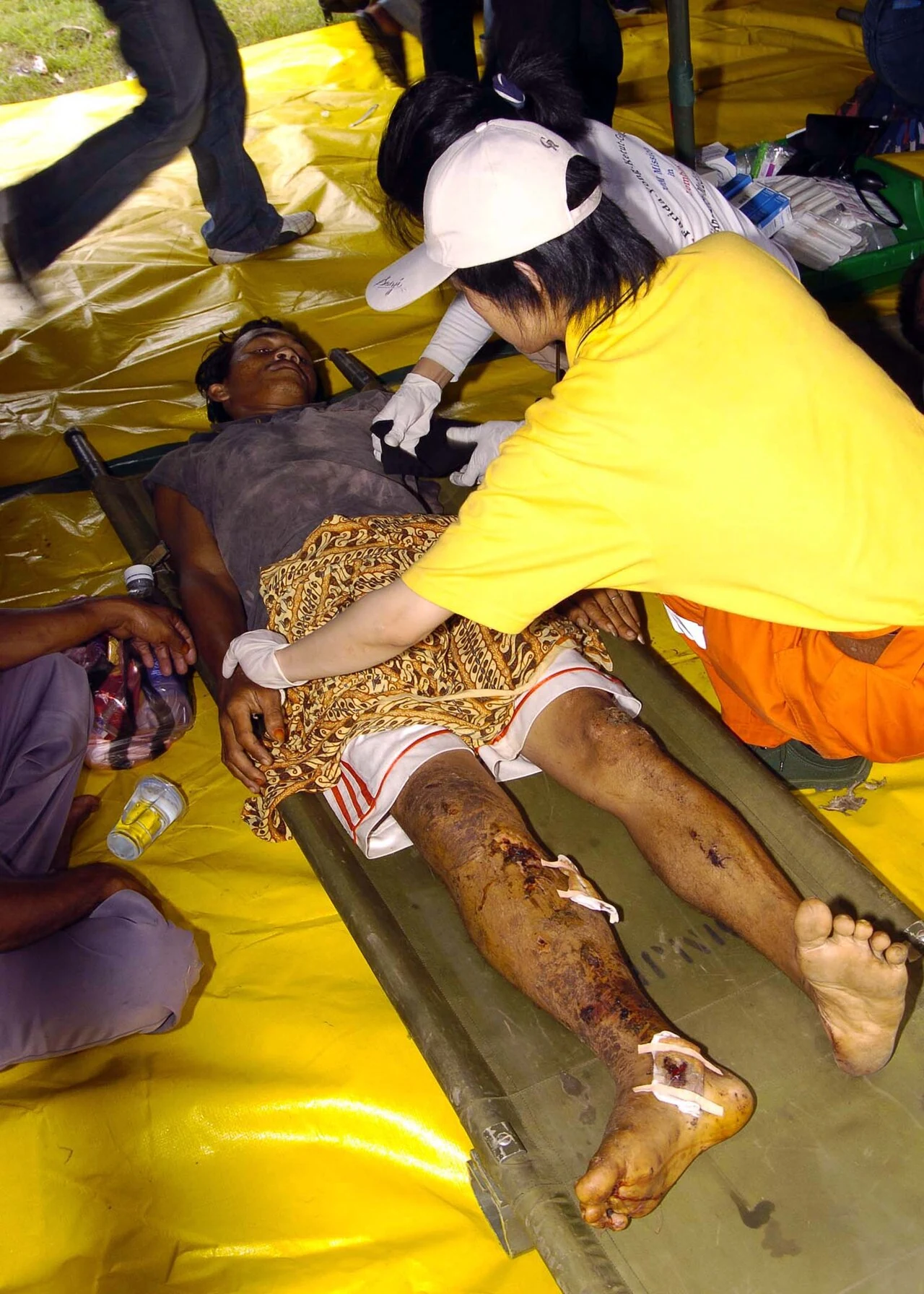 Medical personnel treat a tsunami survivor evacuated by helicopter. Aceh, 3 January 2005.